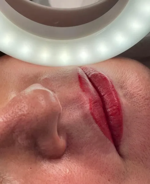 Lippen · 3
