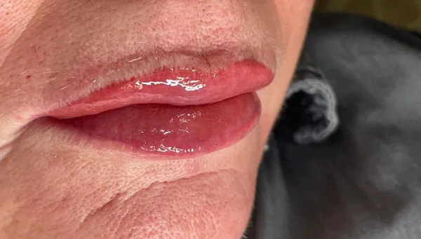 Lippen · 5
