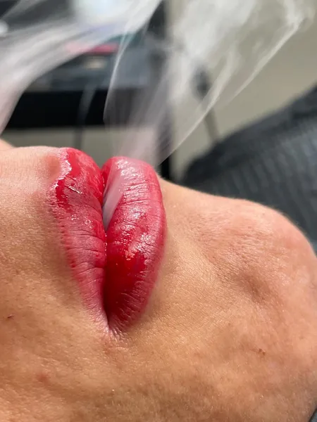 Lippen · 6